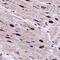 Egl-9 Family Hypoxia Inducible Factor 3 antibody, NB100-303, Novus Biologicals, Immunohistochemistry frozen image 