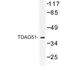 Pleckstrin Homology Like Domain Family A Member 1 antibody, LS-C177073, Lifespan Biosciences, Western Blot image 