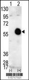 PKB beta antibody, 62-604, ProSci, Western Blot image 