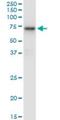 Hexosaminidase Subunit Alpha antibody, H00003073-M06, Novus Biologicals, Western Blot image 