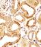 Histone Deacetylase 8 antibody, orb224107, Biorbyt, Immunohistochemistry paraffin image 