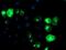 Transferrin Receptor 2 antibody, MA5-25928, Invitrogen Antibodies, Immunocytochemistry image 