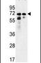 Patatin Like Phospholipase Domain Containing 8 antibody, PA5-24642, Invitrogen Antibodies, Western Blot image 