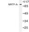 Myocardin Related Transcription Factor A antibody, LS-C176943, Lifespan Biosciences, Western Blot image 