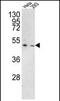 Transmembrane Serine Protease 3 antibody, PA5-35325, Invitrogen Antibodies, Western Blot image 