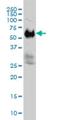 Interferon Related Developmental Regulator 2 antibody, H00007866-M01, Novus Biologicals, Western Blot image 