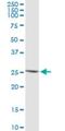 Interferon Epsilon antibody, H00338376-M01, Novus Biologicals, Western Blot image 