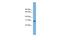 Nascent polypeptide-associated complex subunit alpha antibody, PA5-68929, Invitrogen Antibodies, Western Blot image 