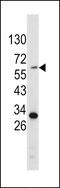 Tyrosinase antibody, LS-C160356, Lifespan Biosciences, Western Blot image 