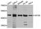 Transforming Growth Factor Beta Receptor 1 antibody, orb373012, Biorbyt, Western Blot image 