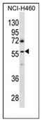 Gamma-Aminobutyric Acid Type A Receptor Rho3 Subunit (Gene/Pseudogene) antibody, AP51793PU-N, Origene, Western Blot image 