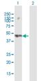 Sorting Nexin 32 antibody, H00254122-B01P, Novus Biologicals, Western Blot image 