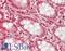 Zinc Finger MYND-Type Containing 11 antibody, LS-B13755, Lifespan Biosciences, Immunohistochemistry paraffin image 