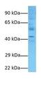 ADP Ribosylation Factor Like GTPase 13B antibody, GTX45702, GeneTex, Western Blot image 