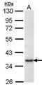 Ribose-phosphate pyrophosphokinase 1 antibody, GTX102570, GeneTex, Western Blot image 