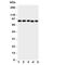 Inhibitor Of Nuclear Factor Kappa B Kinase Subunit Beta antibody, R31145, NSJ Bioreagents, Western Blot image 