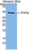 Complement component C3a antibody, LS-C314486, Lifespan Biosciences, Western Blot image 