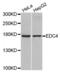 Enhancer Of MRNA Decapping 4 antibody, abx002433, Abbexa, Western Blot image 