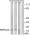 Mitochondrial Ribosomal Protein L20 antibody, TA315562, Origene, Western Blot image 