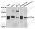 Dynactin Subunit 6 antibody, A8316, ABclonal Technology, Western Blot image 