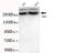 Chromodomain Helicase DNA Binding Protein 3 antibody, STJ99070, St John