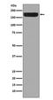 Erb-B2 Receptor Tyrosine Kinase 4 antibody, M00296-1, Boster Biological Technology, Western Blot image 