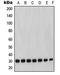 Matrix Metallopeptidase 7 antibody, LS-C352526, Lifespan Biosciences, Western Blot image 