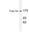 DNA Topoisomerase II Alpha antibody, LS-C177115, Lifespan Biosciences, Western Blot image 