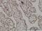 Structural Maintenance Of Chromosomes 6 antibody, H00079677-M01, Novus Biologicals, Immunohistochemistry frozen image 