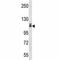 c-Kit antibody, F40157-0.4ML, NSJ Bioreagents, Western Blot image 