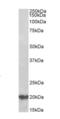 DnaJ Heat Shock Protein Family (Hsp40) Member C5 antibody, orb12269, Biorbyt, Western Blot image 
