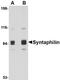 Syntaphilin antibody, NBP1-76915, Novus Biologicals, Western Blot image 
