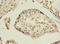 Hepatitis A Virus Cellular Receptor 1 antibody, A50652-100, Epigentek, Immunohistochemistry paraffin image 