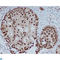 Chromobox 5 antibody, LS-C812997, Lifespan Biosciences, Immunohistochemistry paraffin image 