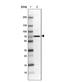 CF Transmembrane Conductance Regulator antibody, NBP1-89315, Novus Biologicals, Western Blot image 