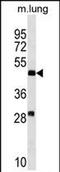 Ring Finger Protein 150 antibody, PA5-72065, Invitrogen Antibodies, Western Blot image 