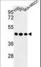 Glycoprotein A33 antibody, LS-C166592, Lifespan Biosciences, Western Blot image 