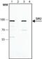 Sirtuin 2 antibody, GTX12193, GeneTex, Western Blot image 