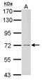 Growth Factor Receptor Bound Protein 10 antibody, NBP2-16742, Novus Biologicals, Western Blot image 