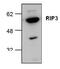 Receptor Interacting Serine/Threonine Kinase 3 antibody, GTX59865, GeneTex, Western Blot image 