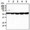 UDP-Glucose 6-Dehydrogenase antibody, GTX57674, GeneTex, Western Blot image 