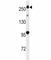 Leucine Rich Repeat Kinase 2 antibody, F50112-0.4ML, NSJ Bioreagents, Western Blot image 