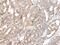 Collagen Type XI Alpha 1 Chain antibody, PA5-68410, Invitrogen Antibodies, Immunohistochemistry frozen image 