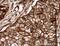 Endothelin Converting Enzyme 1 antibody, 26088-1-AP, Proteintech Group, Immunohistochemistry paraffin image 