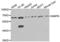 Matrix Metallopeptidase 8 antibody, LS-C335195, Lifespan Biosciences, Western Blot image 