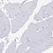 Laminin Subunit Gamma 3 antibody, NBP2-33895, Novus Biologicals, Immunohistochemistry paraffin image 