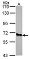 Acyl-CoA Oxidase 3, Pristanoyl antibody, LS-C186392, Lifespan Biosciences, Western Blot image 