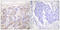 TNF Receptor Superfamily Member 1A antibody, LS-C118621, Lifespan Biosciences, Immunohistochemistry paraffin image 