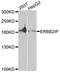 Erbb2 Interacting Protein antibody, A8585, ABclonal Technology, Western Blot image 