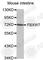 F-Box And WD Repeat Domain Containing 7 antibody, A5273, ABclonal Technology, Western Blot image 